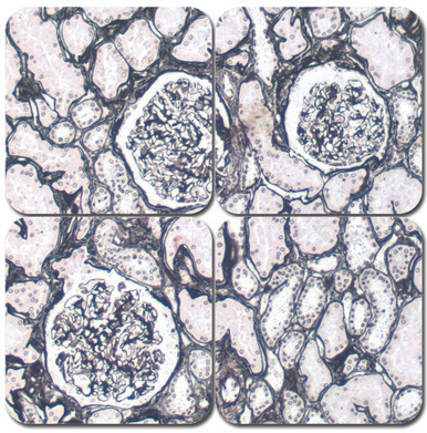 Jones Basement Membrane Reticulum Kit - StatLab