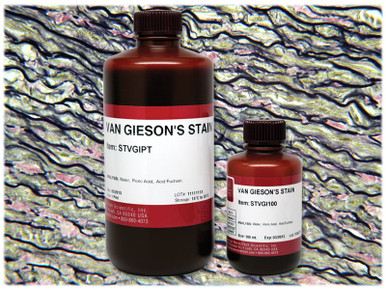 Van Gieson's Stain