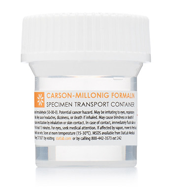 10% Modified Carson/Millonig Formalin Prefills