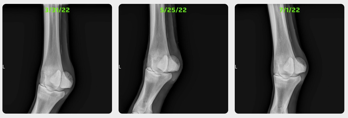 Radiographs
