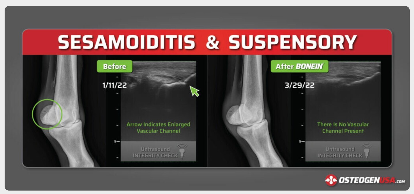 Sesamoiditis & Suspensory