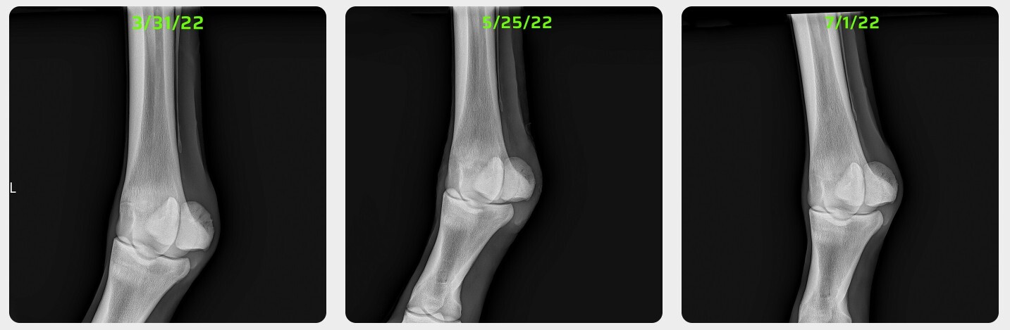 Radiographs