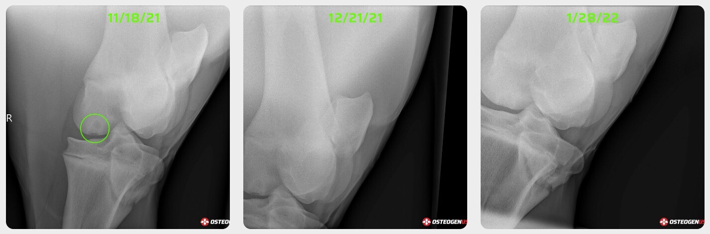 Radiographs