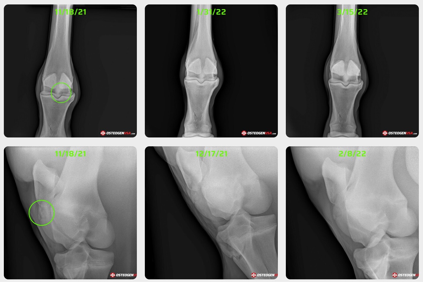 Radiograph