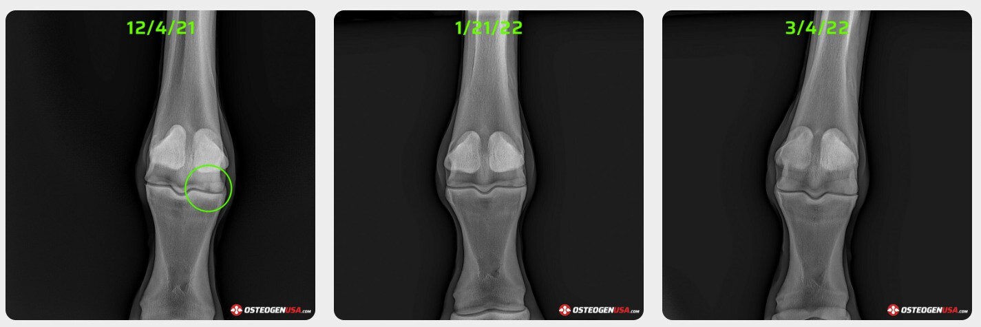 Radiograph