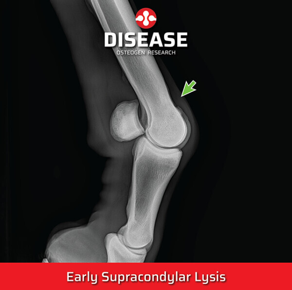 Early Supracondylar Lysis