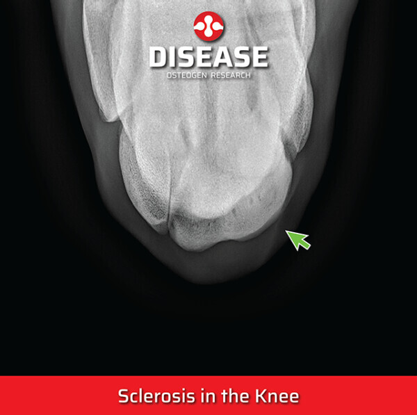 Sclerosis in the Knee