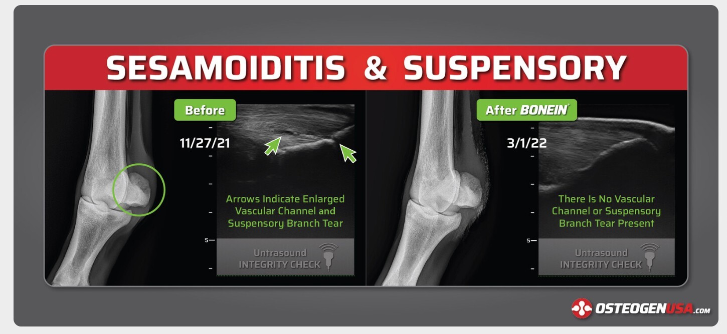 Sesamoiditis & Suspensory