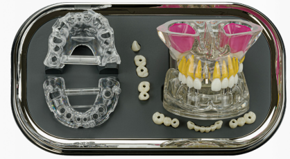 OneGuide カウンセリング 模型