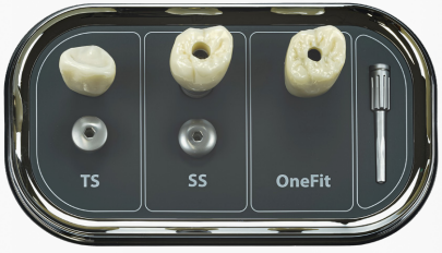 インプラント 相談模型