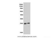 Western Blot analysis of Rat liver and Rat kidney tissue using CRP Polyclonal Antibody at dilution of 1:600