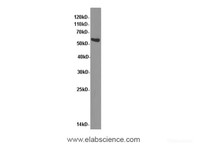 Western Blot analysis of Rat brain tissue using NAMPT Polyclonal Antibody at dilution of 1:600