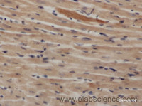 Immunohistochemistry of paraffin-embedded Rat heart using NAMPT Polyclonal Antibody at dilution of 1:50