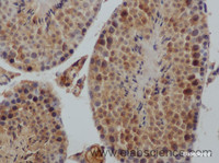 Immunohistochemistry of paraffin-embedded Rat testis using IGF1 Polyclonal Antibody at dilution of 1:50