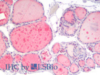 Immunohistochemistry analysis of paraffin-embedded Human Thyroid using IGF1 Polyclonal Antibody (Elabscience® Product Detected by Lifespan) .