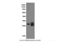 Western Blot analysis of Rat kidney and Mouse kidney tissue using TNF alpha Polyclonal Antibody at dilution of 1:600