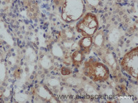 Immunohistochemistry of paraffin-embedded Rat kidney using TNF alpha Polyclonal Antibody at dilution of 1:50