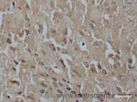 Immunohistochemistry of paraffin-embedded Mouse brain using LUM Polyclonal Antibody at dilution of 1:50