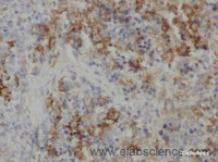 Immunohistochemistry of paraffin-embedded Rat spleen using Metallothionein Polyclonal Antibody at dilution of 1:50