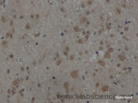 Immunohistochemistry of paraffin-embedded Rat brain using AKT1 Polyclonal Antibody at dilution of 1:50