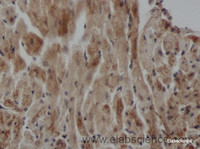 Immunohistochemistry of paraffin-embedded Rat heart using ARF6 Polyclonal Antibody at dilution of 1:50