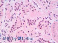 Immunohistochemistry analysis of paraffin-embedded Human Kidney using RELB Polyclonal Antibody (Elabscience® Product Detected by Lifespan) .