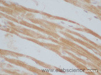 Immunohistochemistry of paraffin-embedded Mouse heart using UCP3 Polyclonal Antibody at dilution of 1:50