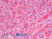 Immunohistochemistry analysis of paraffin-embedded Human Spleen using STAT1 Polyclonal Antibody (Elabscience® Product Detected by Lifespan) .