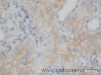 Immunohistochemistry of paraffin-embedded Rat kidney using CD70 Polyclonal Antibody at dilution of 1:50