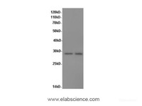 Western Blot analysis of A431 cells and Rat spleen tissue using Proliferating Cell Nuclear Antigen Polyclonal Antibody at dilution of 1:600