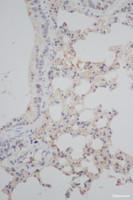Immunohistochemistry of paraffin-embedded Mouse lung using PCNA Polyclonal Antibody at dilution of 1:50