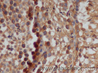 Immunohistochemistry of paraffin-embedded Rat testis using CD46 Polyclonal Antibody at dilution of 1:50