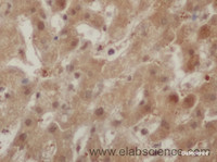 Immunohistochemistry of paraffin-embedded Rat liver using ENO1 Polyclonal Antibody at dilution of 1:50