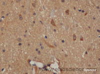 Immunohistochemistry of paraffin-embedded Mouse brain using ENO1 Polyclonal Antibody at dilution of 1:50