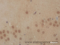 Immunohistochemistry of paraffin-embedded Mouse brain using PBK Polyclonal Antibody at dilution of 1:50