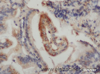Immunohistochemistry of paraffin-embedded Rat colon using CK-20 Polyclonal Antibody at dilution of 1:50