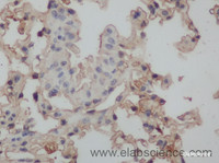 Immunohistochemistry of paraffin-embedded Rat lung using CAMP Polyclonal Antibody at dilution of 1:50