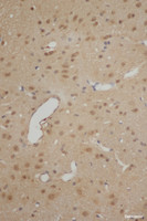 Immunohistochemistry of paraffin-embedded Mouse brain using IL10 Polyclonal Antibody at dilution of 1:50