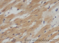 Immunohistochemistry of paraffin-embedded Rat heart using IL6 Polyclonal Antibody at dilution of 1:50