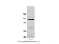 Western Blot analysis of Jurkat cells using Casp2 Polyclonal Antibody at dilution of 1:600