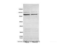 Western Blot analysis of HeLa and HuvEC cells using TGM2 Polyclonal Antibody at dilution of 1:600