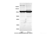 Western bot analysis of HeLa and 293T cells using SDHA Polyclonal Antibody at dilution of 1:600