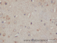 Immunohistochemistry of paraffin-embedded Rat brain using SDHA Polyclonal Antibody at dilution of 1:50