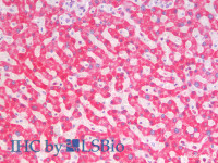 Immunohistochemistry analysis of paraffin-embedded Human Liver using SDHA Polyclonal Antibody (Elabscience® Product Detected by Lifespan) .