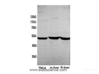 Western Blot analysis of HeLa, Mouse liver and Rat liver using FH Polyclonal Antibody at dilution of 1:600