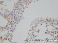 Immunohistochemistry of paraffin-embedded Mouse lung using EEF1E1 Polyclonal Antibody at dilution of 1:50