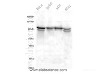 Western Blot analysis of HeLa, A431, Jurkat, A431 and K562 cells using EZR Polyclonal Antibody at dilution of 1:600