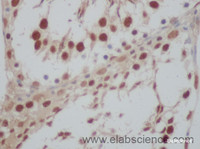 Immunohistochemistry of paraffin-embedded Rat testis using ILF2 Polyclonal Antibody at dilution of 1:50