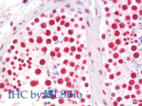 Immunohistochemistry analysis of paraffin-embedded Human Testis using EEF1E1 Polyclonal Antibody (Elabscience® Product Detected by Lifespan) .