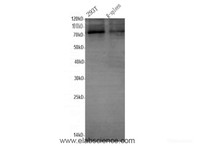 Western Blot analysis of 293T and Rat spleen using PRKCA Polyclonal Antibody at dilution of 1:600